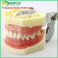 DENTAL27(12609) Treating Periodontal Diseases Training Jaw Models